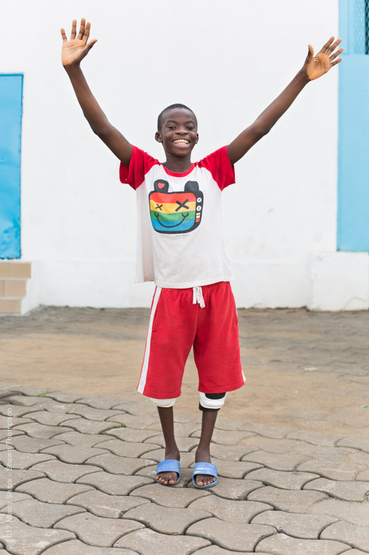 Ulrich, orthopedic patient, stands joyfully with his newly straightened legs.